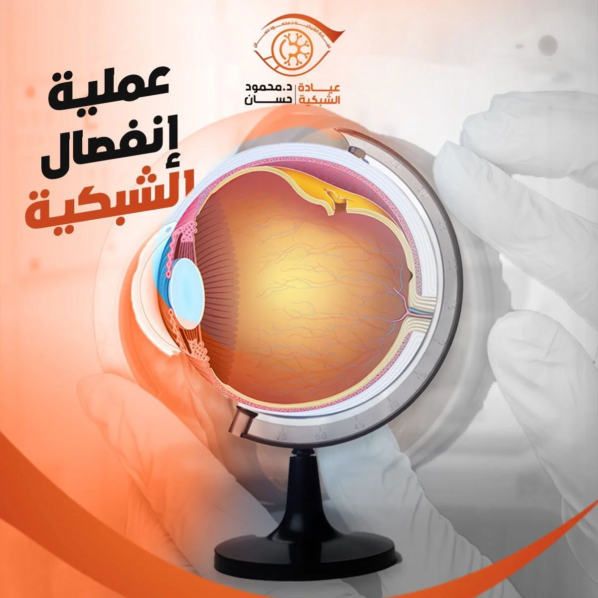 اعراض انفصال الشبكية و أسبابه: دليلك الشامل للوقاية والعلاج